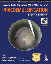 Jaypee Gold Standard Mini Atlas Series: Phacoemulsification (with DVD)|2/e