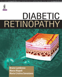Diabetic Retinopathy|1/e