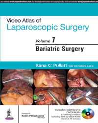 Video Atlas of Laparoscopic Surgeryâ€”Bariatric Surgery (Vol. 1) Includes Interactive DVD-ROM|1/e