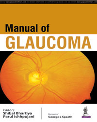 Manual of Glaucoma|1/e