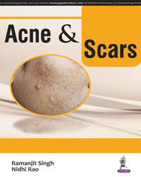Acne & Scars|1/e