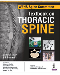 WFNS Spine Committee Textbook on Thoracic Spine|1/e