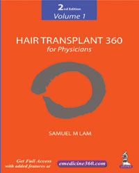 Hair Transplant 360 for Physicians  Volume 1|2/e