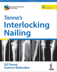 Tannaâ€™s Interlocking Nailing|4/e