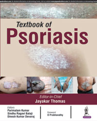 Textbook of Psoriasis|1/e
