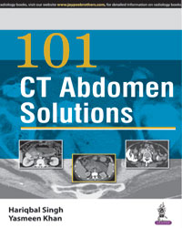 101 CT Abdomen Solutions|1/e