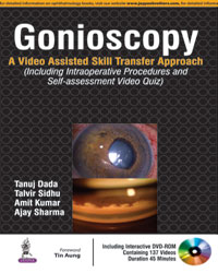 Gonioscopy: A Video Assisted Skill Transfer Approach (Includes Interactive DVD-ROM )|1/e