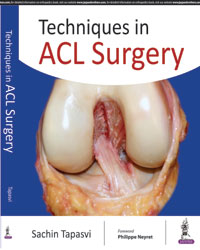 Techniques in ACL Surgery|1/e
