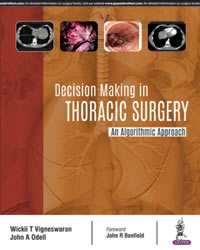 Decision Making in Thoracic Surgery: An Algorithmic Approach|1/e