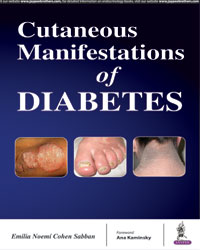 Cutaneous Manifestations of Diabetes|1/e