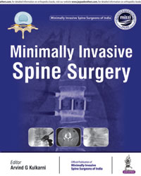 Minimally Invasive Spine Surgery|1/e