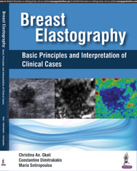 Breast Elastography: Basic Principles and Interpretation of Clinical Cases|1/e
