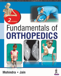 Fundamentals of Orthopedics|2/e