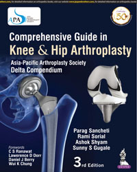 Comprehensive Guide in Knee & Hip Arthroplasty|3/e
