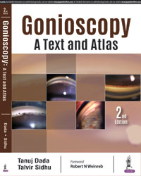 Gonioscopy: A Text and Atlas|2/e