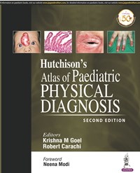 Hutchisonâ€™s Atlas of Paediatric Physical Diagnosis|2/e