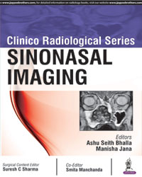 Clinico Radiological Series: Sinonasal Imaging|1/e