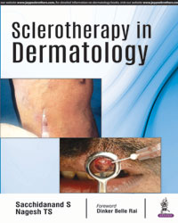 Sclerotherapy in Dermatology|1/e