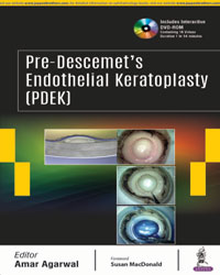 Pre-Descemetâ€™s Endothelial Keratoplasty (PDEK) Includes Interactive DVD-ROM|1/e