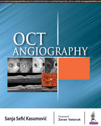 OCT Angiography|1/e