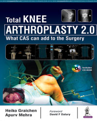 Total Knee Arthroplasty 2.0 What CAS can add to the Surgery (Includes CD-ROM)|1/e