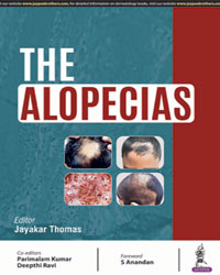 The Alopecias|1/e