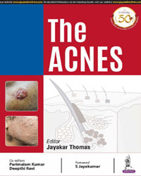 The Acnes|1/e