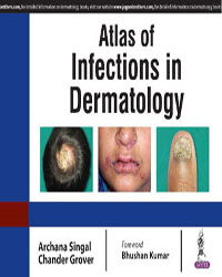 Atlas of Infections in Dermatology|1/e