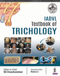 IADVL Textbook of Trichology|1/e