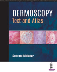 Dermoscopy: Text and Atlas|1/e