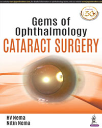 Gems of Ophthalmologyâ€”Cataract Surgery|1/e