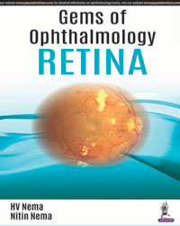 Gems of Ophthalmologyâ€”Retina|1/e