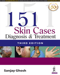 151 Skin Cases: Diagnosis & Treatment|3/e