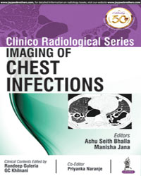 Clinico Radiological Series: Imaging of Chest Infections|1/e