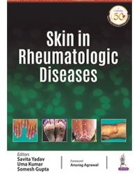 Skin in Rheumatologic Diseases |
