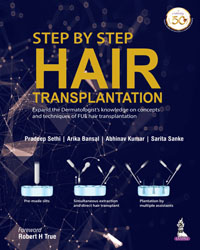 Step by Step Hair Transplantation|1/e
