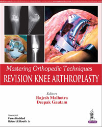 Mastering Orthopedic Techniques:Revision Knee Arthroplasty|1/e