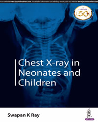 Chest X-ray in Neonates and Children|1/e