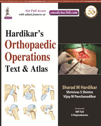 Hardikarâ€™s Orthopaedic Operations: Text & Atlas|1/e