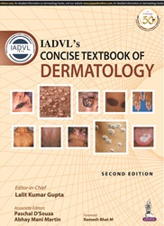 IADVLâ€™s Concise Textbook of Dermatology|2/e