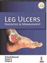 Leg Ulcers Diagnosis & Management|1/e