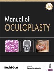 Manual of Oculoplasty|1/e
