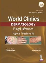 World Clinics Dermatology Fungal Infections Topical Treatments|Volume 5  Number 1
