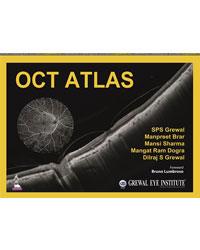 OCT Atlas|1/e