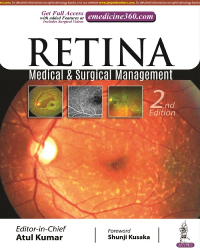 Retina: Medical & Surgical Management|2/e