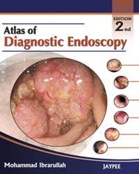 Atlas of  Diagnostic Endoscopy|2/e