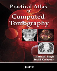 Practical Atlas of Computed Tomography|1/e