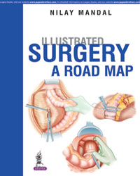 Illustrated Surgery â€“ A Road Map|1/e