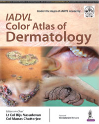 IADVL Color Atlas of Dermatology|1/e