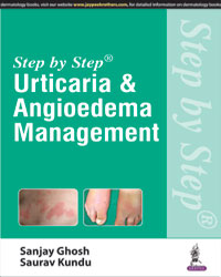 Step by Step Urticaria and Angioedema Management|1/e